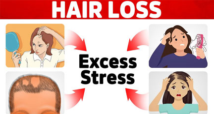 اثر استرس بر ریزش مو